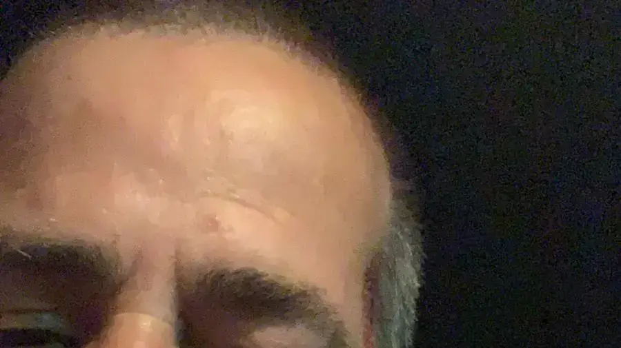 כתב המשטרה של ישראל היום, דניאל סיריוטי לאחר שהותקף בקריות כתב המשטרה של ישראל היום, דניאל סיריוטי לאחר שהותקף בקריות