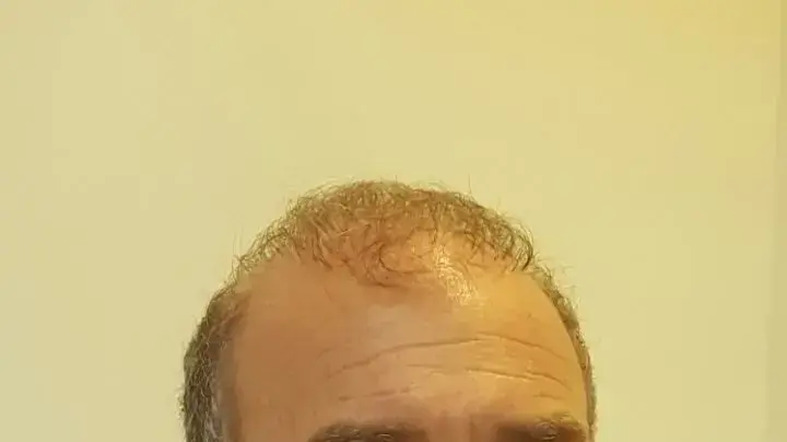 מאיר שפיגלר מנכ"ל הביטוח הלאומי מאיר שפיגלר מנכ"ל הביטוח הלאומי