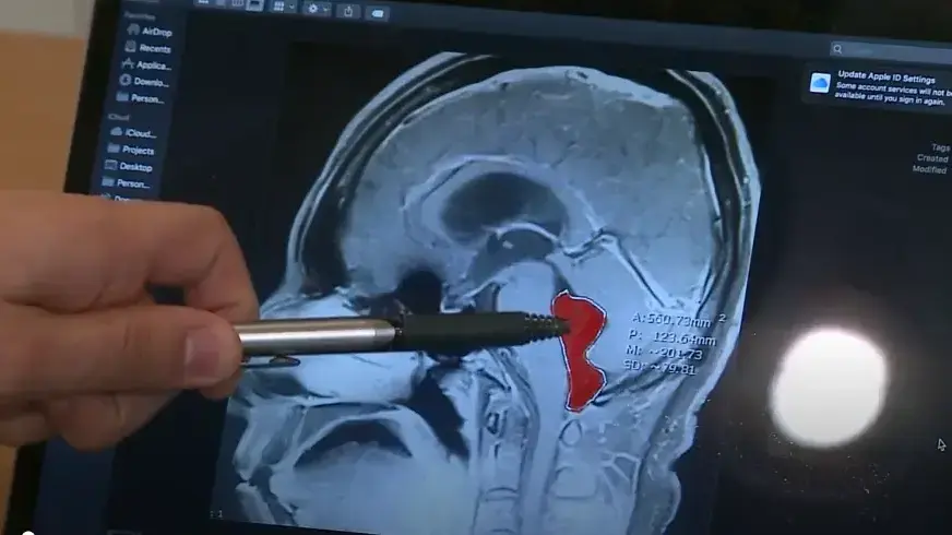 MRI מוח MRI מוח