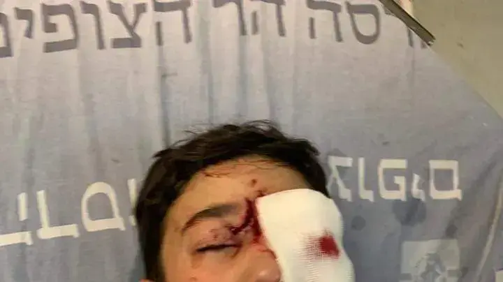 מאלכ עיסא, ילד בן תשע שנפצע מירי כדור ספוג של המשטרה בעיסאוויה, 15 בפברואר 2020
