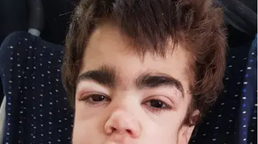 נתנאל יעקובי ילד חולה במחלת האנטר נתנאל יעקובי ילד חולה במחלת האנטר