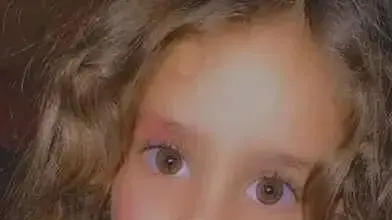 רפיף מחמד סעיד קראעין ילדה בת 4 מסילוואן המתגוררת עם משפחתה בעיסאוויה שנפצעה בראשה מירי כדור תועה והועברה לטיפול נמרץ במצב קשה רפיף מחמד סעיד קראעין ילדה בת 4 מסילוואן המתגוררת עם משפחתה בעיסאוויה שנפצעה בראשה מירי כדור תועה והועברה לטיפול נמרץ במצב קשה