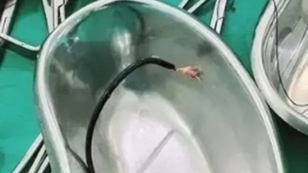 גבר דחף כבל של מטען של טלפון סלולרי באורך 60 סנטימטר לאיבר המין שלו גבר דחף כבל של מטען של טלפון סלולרי באורך 60 סנטימטר לאיבר המין שלו