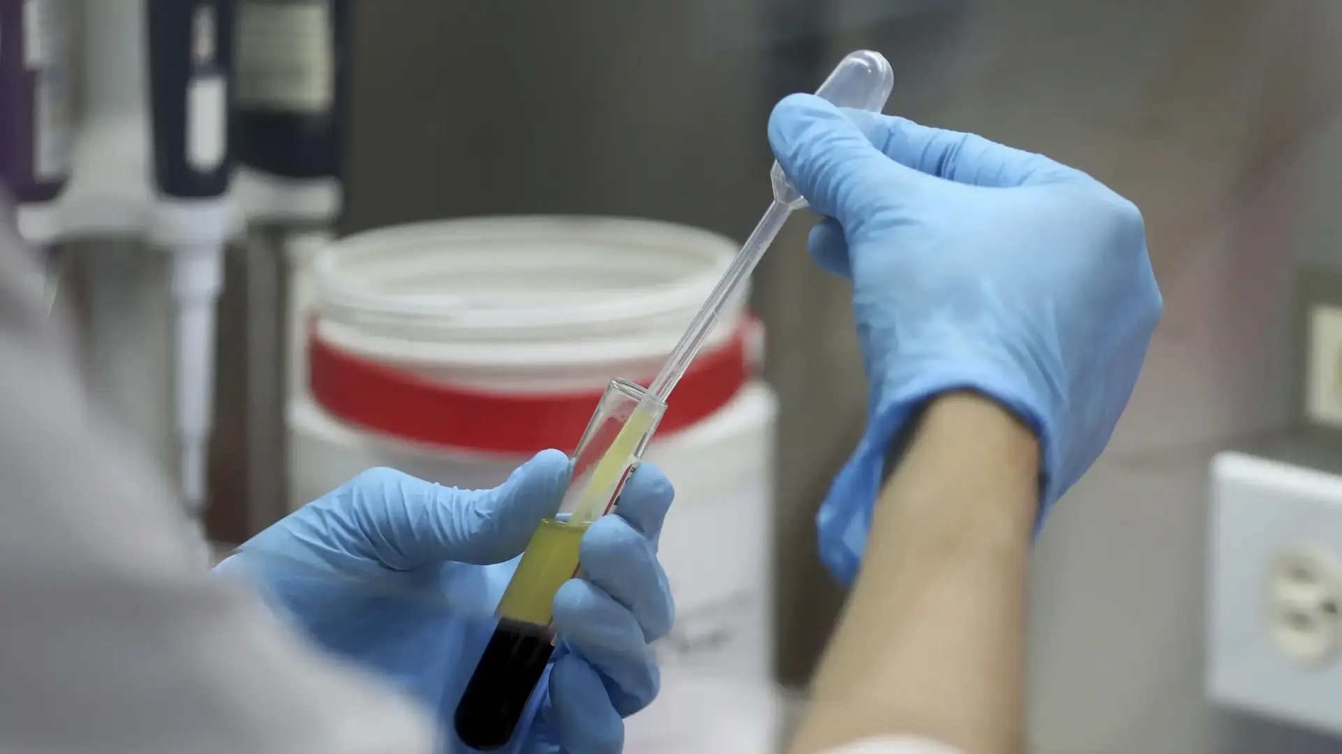 רופא בודק דגימת DNA בבוגוטה שבקולומביה. 14 בנובמבר 2019 רופא בודק דגימת DNA בבוגוטה שבקולומביה. 14 בנובמבר 2019