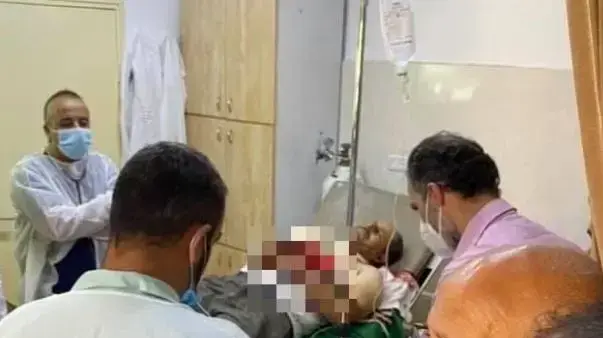 פצוע הירי בבית החולים לאחר חיכוך בין מספר מתיישבים לפלסטינים סמוך למעלה השומרון 5 ביולי 2020