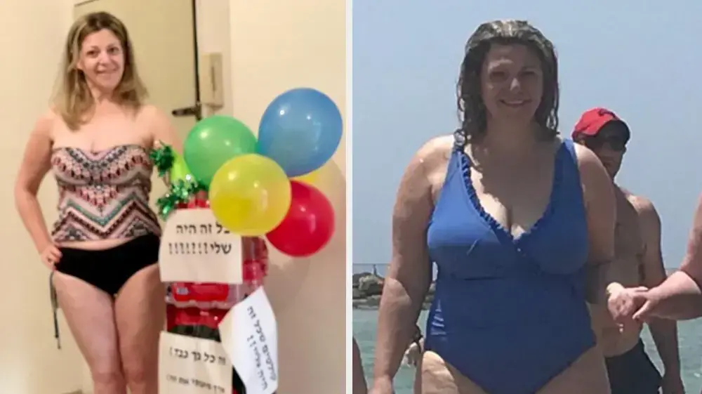 תמונת לפני ואחרי של יונית כפיר