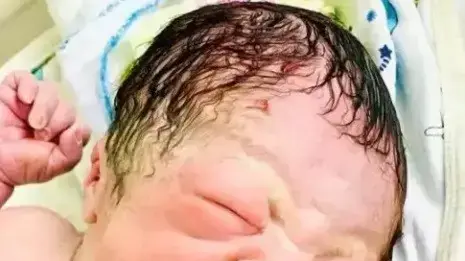 תינוק אוחז בידו את ההתקן התוך רחמי הכושל של אמו תינוק אוחז בידו את ההתקן התוך רחמי הכושל של אמו
