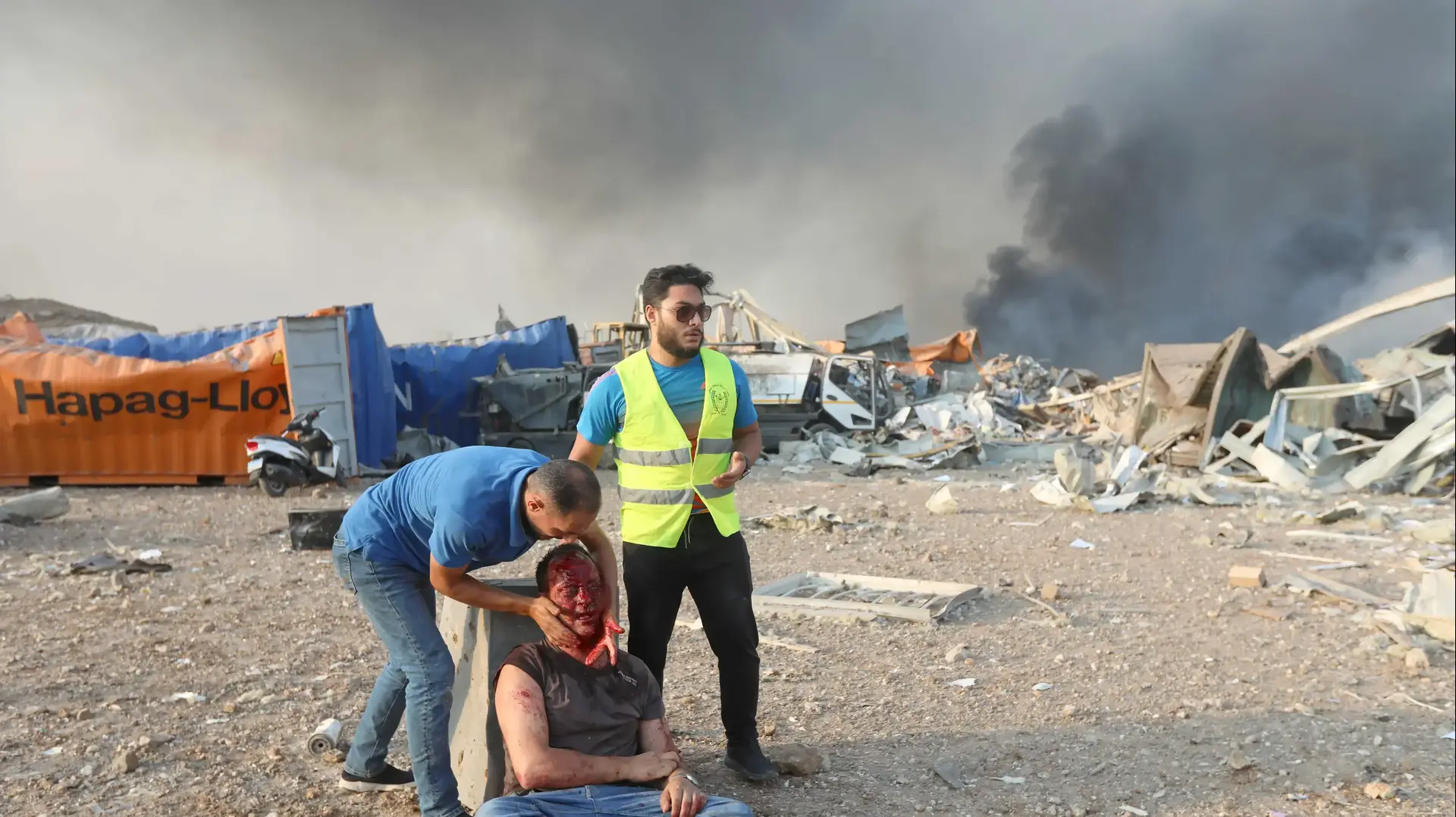 פצוע בעקבות הפיצוץ העז שפקד את נמל ביירות, לבנון 4 באוגוסט 2020 פצוע בעקבות הפיצוץ העז שפקד את נמל ביירות, לבנון 4 באוגוסט 2020