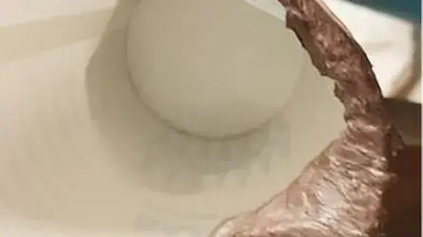 צואה בצבע כסוף של חולת סרטן צואה בצבע כסוף של חולת סרטן