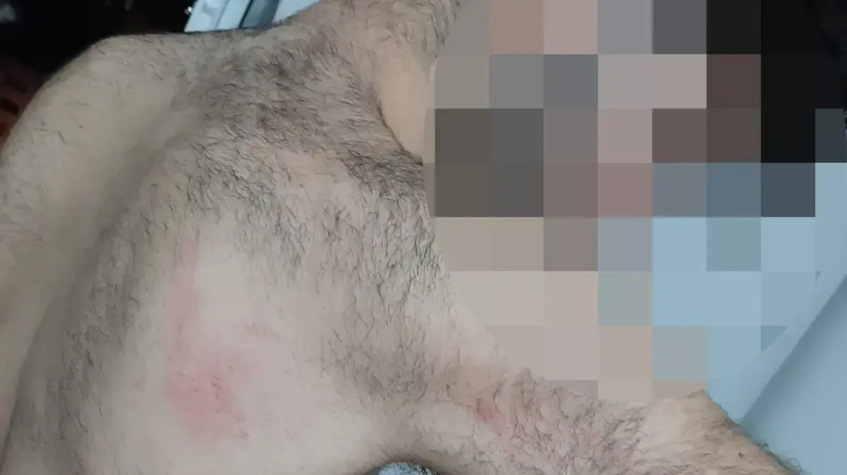 זוג הומואים הותקף בדירתו בטבריה
