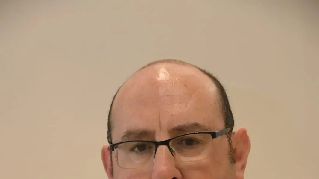 פרופ' יניב שרר, מנהל המרכז הרפואי ברזילי פרופ' יניב שרר, מנהל המרכז הרפואי ברזילי