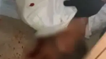הפצוע במהלך פיזור החתונה בהשתתפות עשרות בגבעת זאב 14 באוקטבור 2020 הפצוע במהלך פיזור החתונה בהשתתפות עשרות בגבעת זאב 14 באוקטבור 2020
