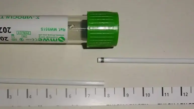 מטוש של בדיקת קורונה שנשבר בתוך קנה הנשימה של מטופלת בבריטניה מטוש של בדיקת קורונה שנשבר בתוך קנה הנשימה של מטופלת בבריטניה