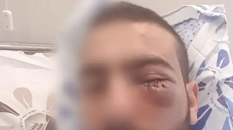 נזקי פצעיתו של סרן בחיל האויר בשירות קבע לאחר שהותקף על-ידי שוטר
נזקי פצעיתו של סרן בחיל האויר בשירות קבע לאחר שהותקף על-ידי שוטר