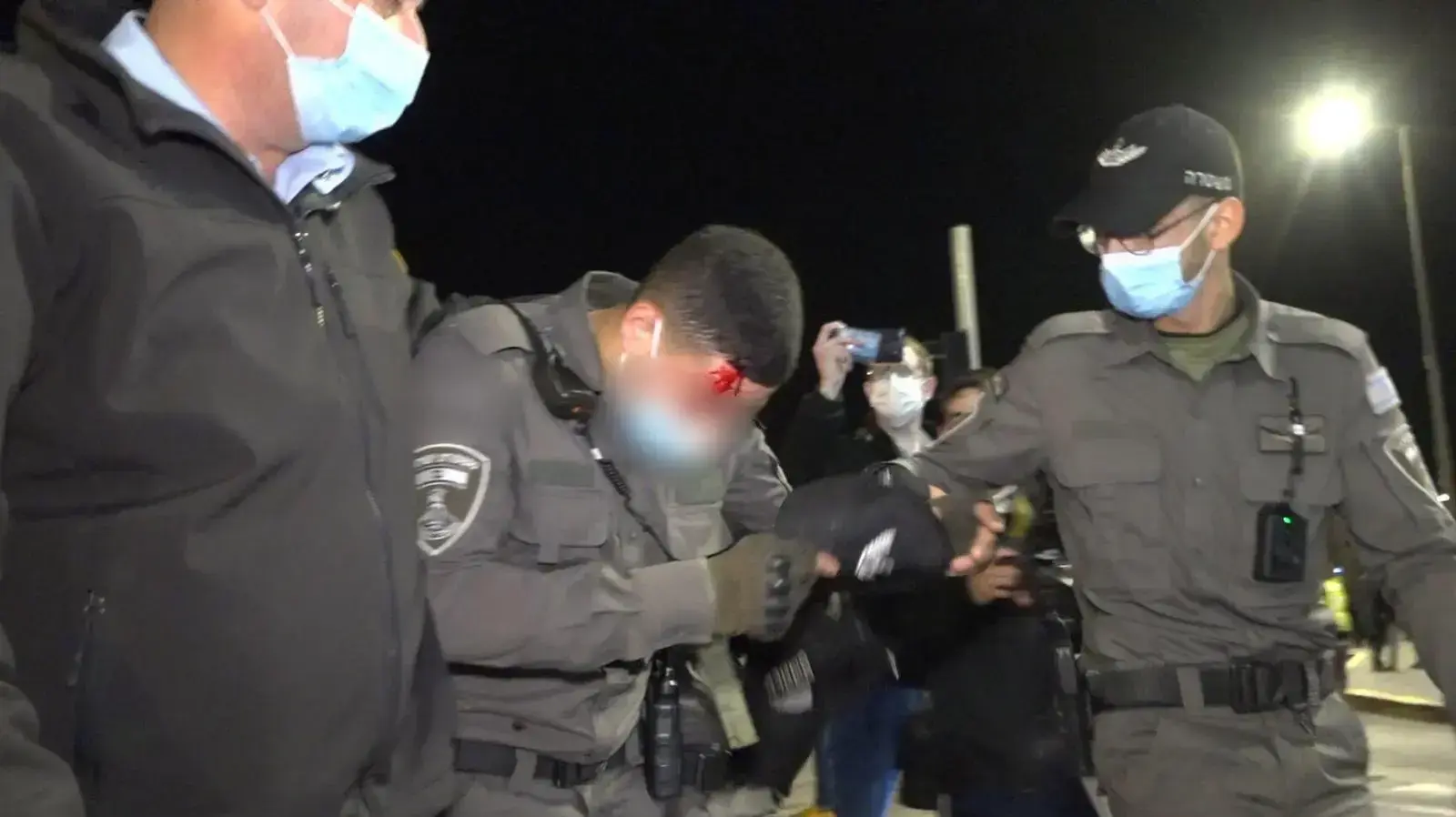 שוטר מג"ב שנפצע מזריקת אבן במהלך הפגנה על מות נער גבעות מול מטה המשטרה הארצי בירושלים. 22 בדצמבר 2020 שוטר מג"ב שנפצע מזריקת אבן במהלך הפגנה על מות נער גבעות מול מטה המשטרה הארצי בירושלים. 22 בדצמבר 2020