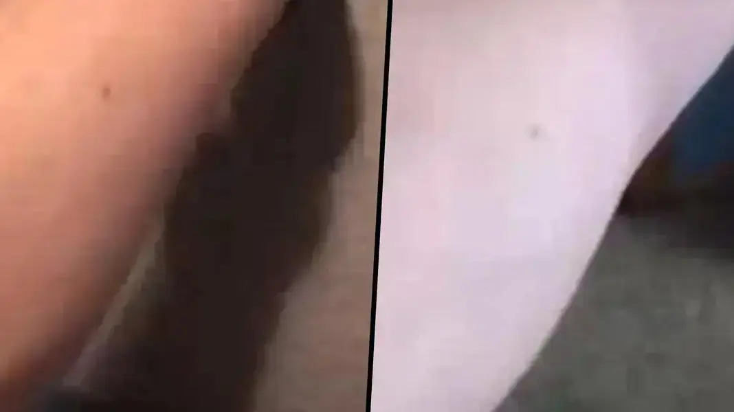 לכל הגברים יש נמש באותו מקום בזרוע? לכל הגברים יש נמש באותו מקום בזרוע?