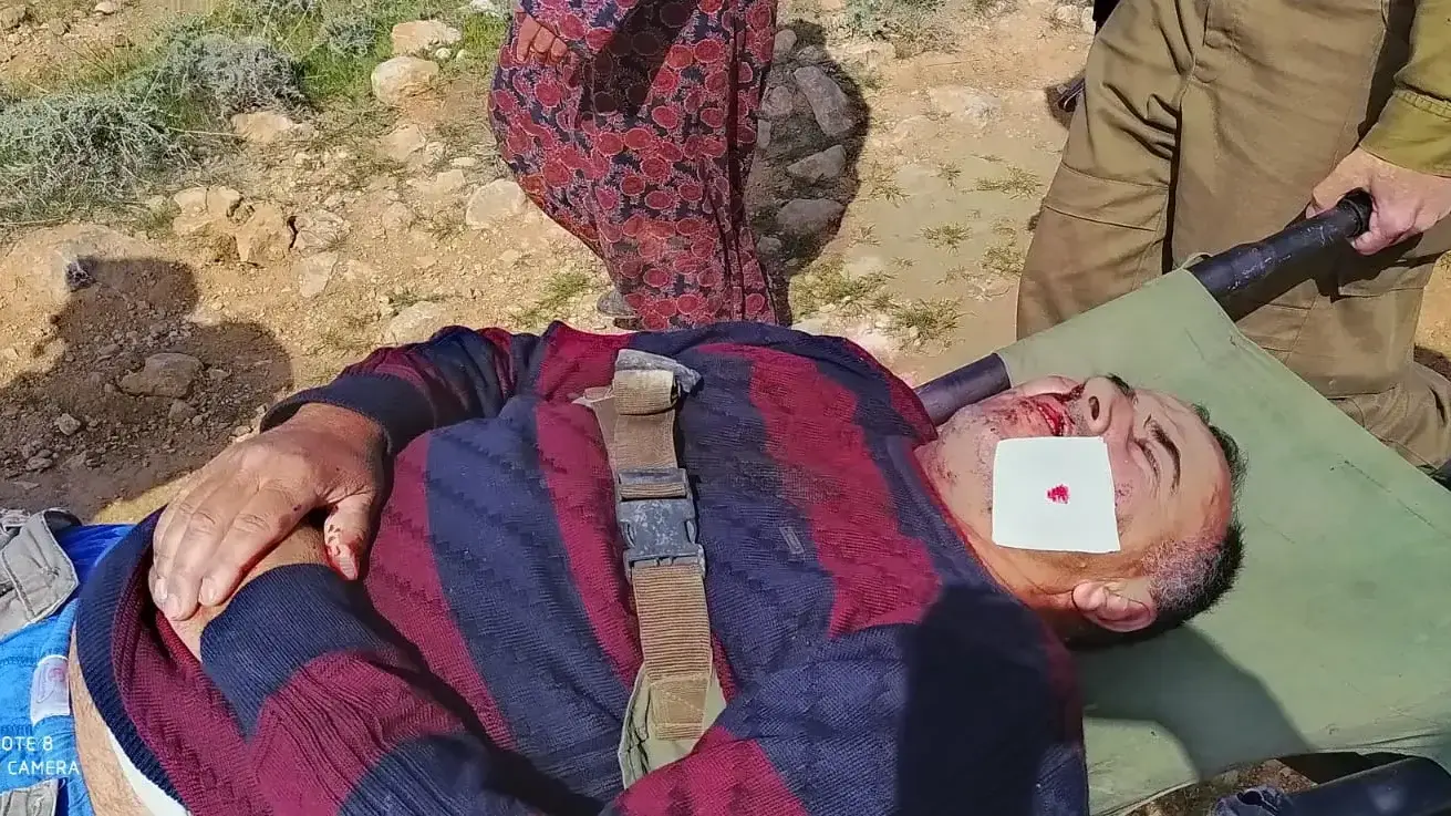 משפחה פלסטינית הותקפה על ידי מתנחלים סמוך למאחז מצפה יאיר בהר חברון. 13 במרץ 2021 משפחה פלסטינית הותקפה על ידי מתנחלים סמוך למאחז מצפה יאיר בהר חברון. 13 במרץ 2021