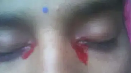 תושבת הודו הזילה דמעות של דם מעיניה תושבת הודו הזילה דמעות של דם מעיניה