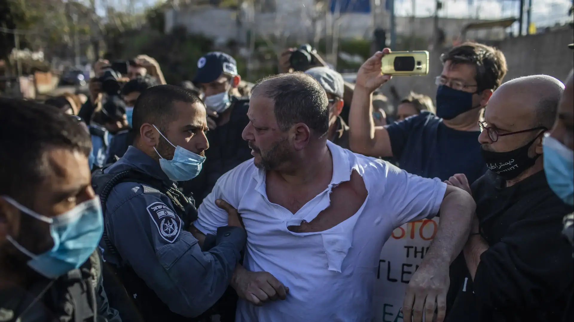 ח"כ עופר כסיף לאחר שהותקף בידי שוטרים בהפגנה בשכונת שיח ג'ראח במזרח ירושלים - 9 באפריל 2021