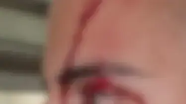 פציעת שוטר בעקבות מהומות במאה שערים, ירושלים 20 באפריל 2021 פציעת שוטר בעקבות מהומות במאה שערים, ירושלים 20 באפריל 2021