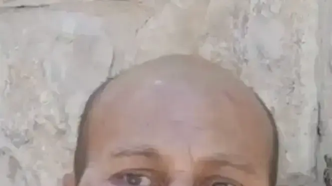 תושב סילוואן שהותקף תושב סילוואן שהותקף