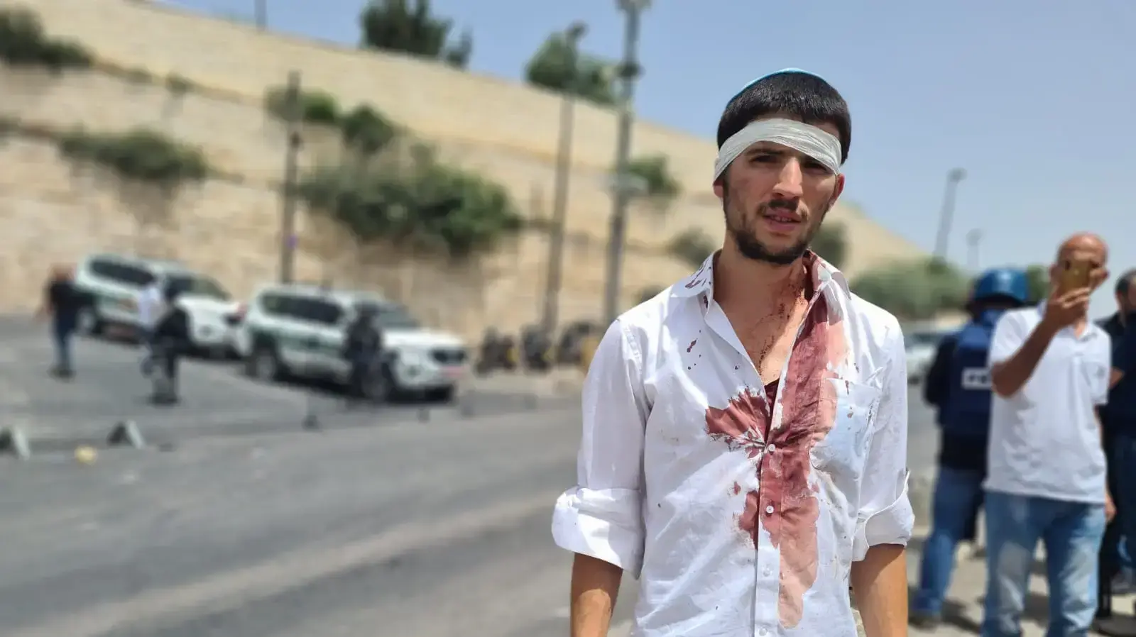 שער האריות: נהג ישראלי איבד שליטה על רכבו בשל יידוי אבנים 10 במאי 2021