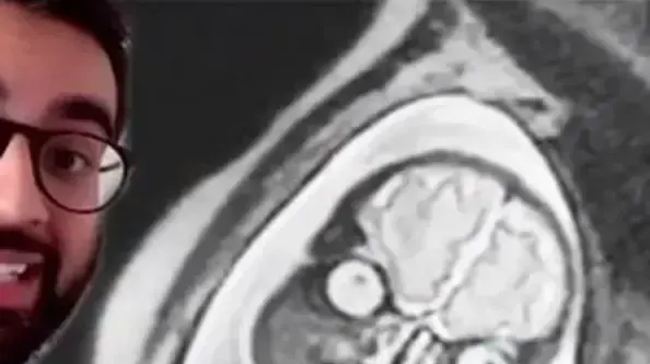 ככה נראים עוברים ב-MRI ככה נראים עוברים ב-MRI