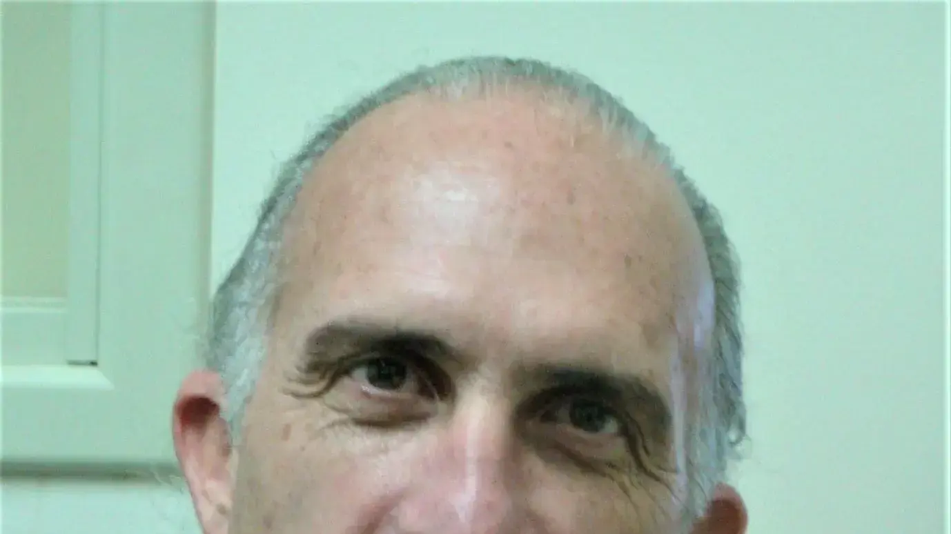 ד״ר טוביה בן גל, מנהל המרפאה להשתלות לב בבית החולים בילינסון