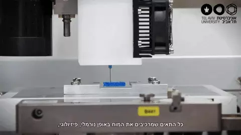 הדפסת תלת-מימד של גידול סרטני מסוג גליובלסטומה הדפסת תלת-מימד של גידול סרטני מסוג גליובלסטומה