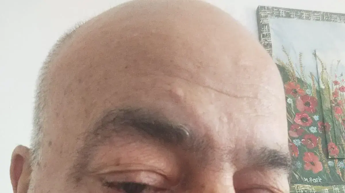 עזרא נהוראי, בן 68 מחולון הסובל ממחלות רקע של סכרת עזרא נהוראי, בן 68 מחולון הסובל ממחלות רקע של סכרת
