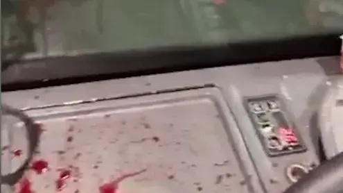 נהג אוטובוס ציבורי הותקף ונפצע בעפולה לפנות בוקר לאחר שהסיע נוסעים בקווי הלילה, 31 באוגוסט 2021 נהג אוטובוס ציבורי הותקף ונפצע בעפולה לפנות בוקר לאחר שהסיע נוסעים בקווי הלילה, 31 באוגוסט 2021