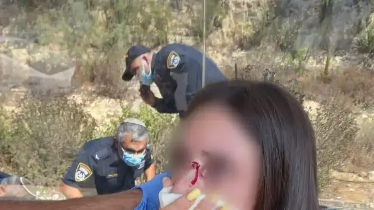 פציעת שוטרת במהלך אכיפת עטיית מסיכה בתחבורה ציבורית סמוך לירושלים 1 בספטמבר 2021 פציעת שוטרת במהלך אכיפת עטיית מסיכה בתחבורה ציבורית סמוך לירושלים 1 בספטמבר 2021