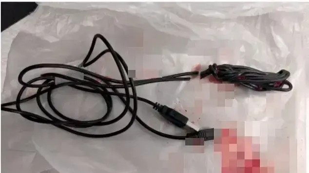 כבל USB נתקע באיבר מין של נער כבל USB נתקע באיבר מין של נער