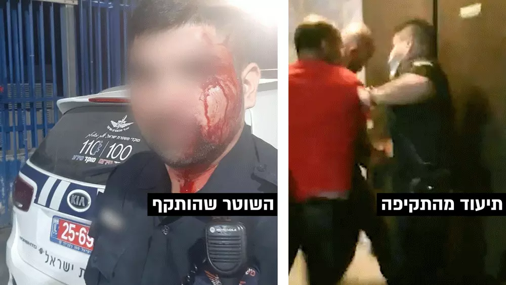 תיעוד השוטר שנתקף בכפר קאסם. 1 באוקטובר 2021
