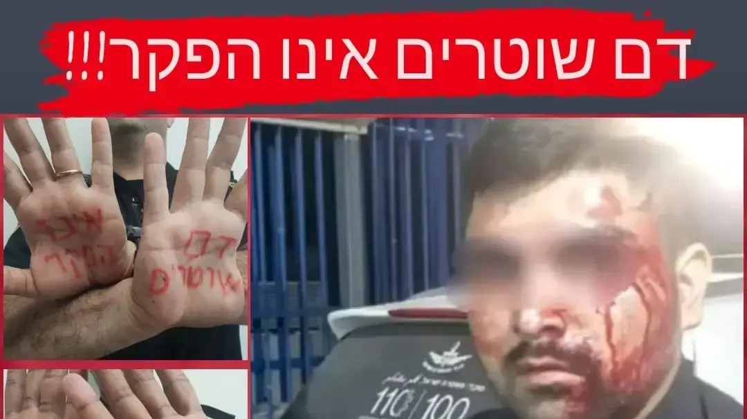 מחאת שוטרים אחרי התקיפה בכפר קאסם מחאת שוטרים אחרי התקיפה בכפר קאסם
