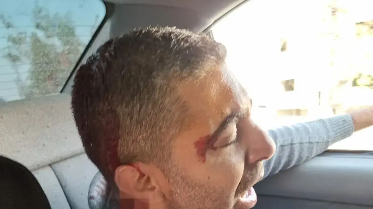 מתנחלים תקפו באבנים פלסטינים בבורקה