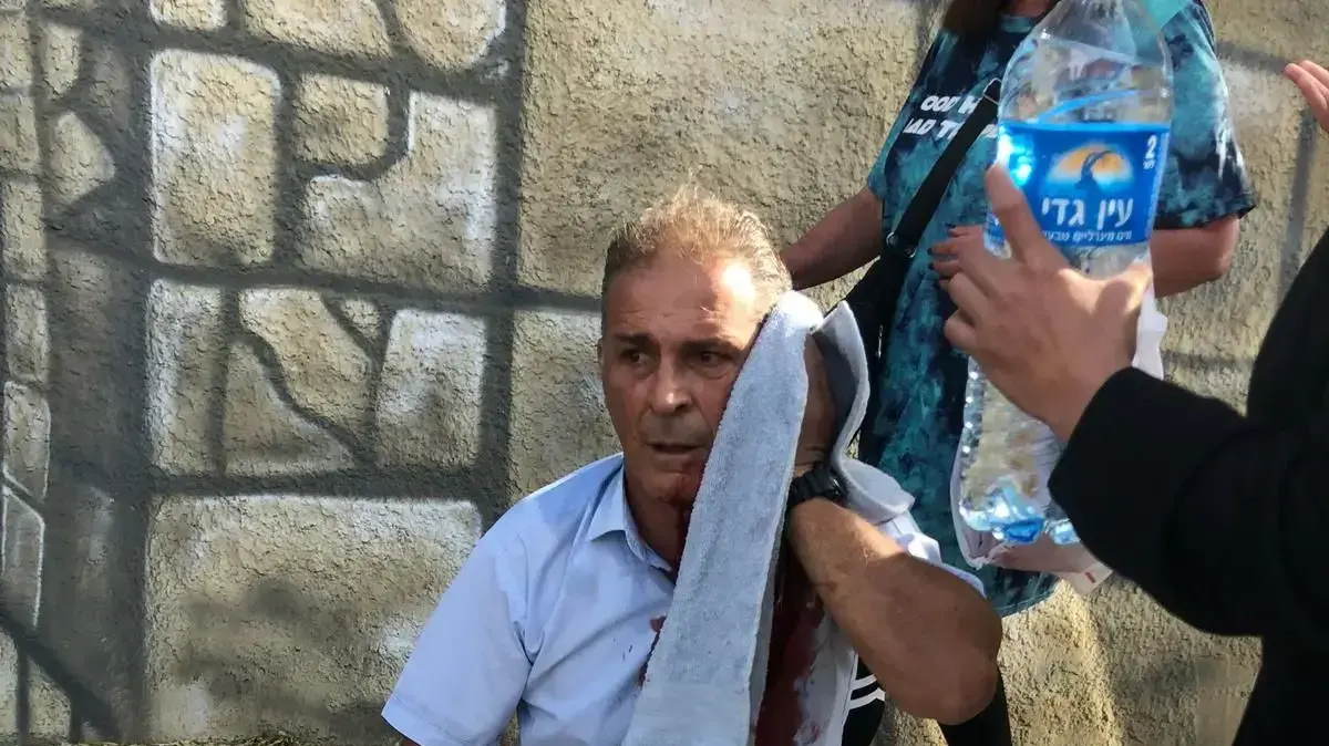 תושב צפת תקף נהג אוטובוס שהעיר שלא שילם על הנסיעה 07 בדצמבר 2021 תושב צפת תקף נהג אוטובוס שהעיר שלא שילם על הנסיעה 07 בדצמבר 2021