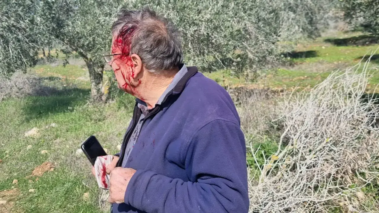 פעילי רבנים לזכויות אדם וקואליציית המסיק הותקפו בכפר בורין בידי מתנחלים בעת שהגיעו לשטח לסייע לחקלאים הפלסטינים, 21 בינואר 2022 פעילי רבנים לזכויות אדם וקואליציית המסיק הותקפו בכפר בורין בידי מתנחלים בעת שהגיעו לשטח לסייע לחקלאים הפלסטינים, 21 בינואר 2022