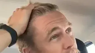 גבר מקריח גידל שיער אחרי שהפסיק לחפוף