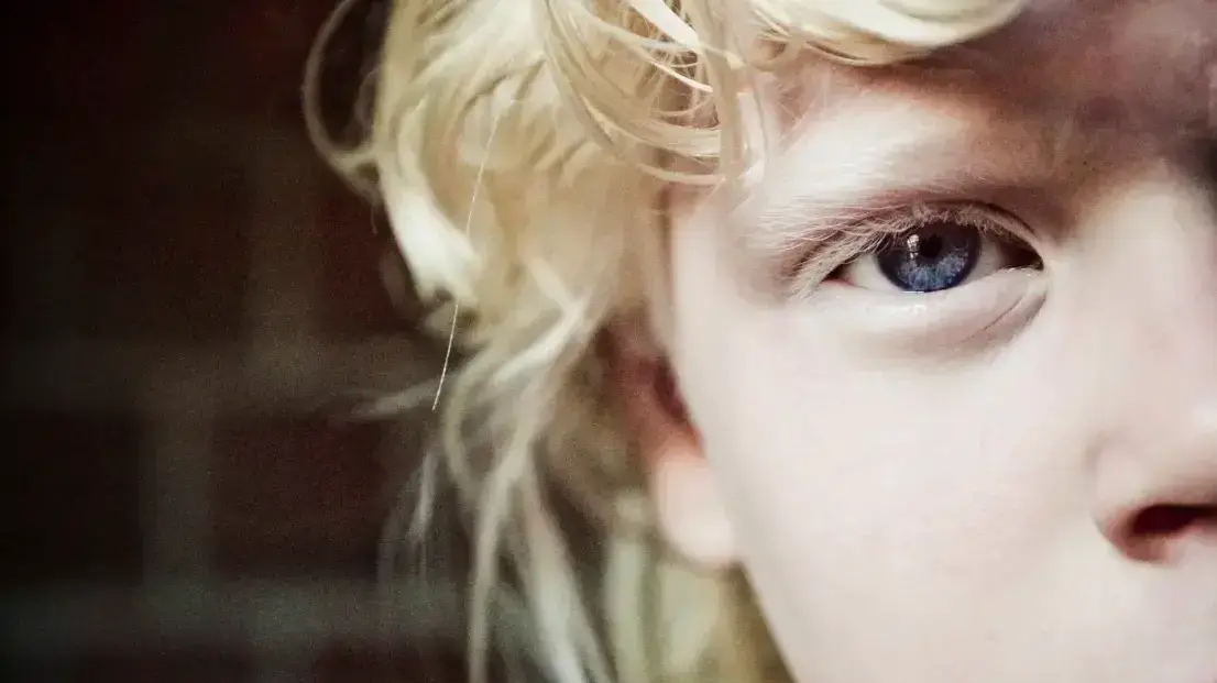 לבקן. 13 ביוני 2022