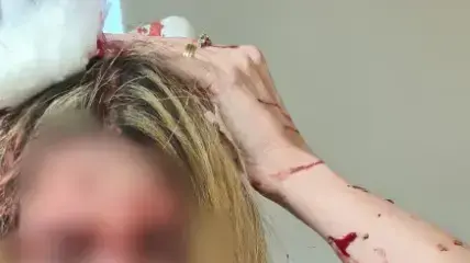 הרופאה שהותקפה עם מוט בקופת חולים