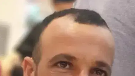 הגבר שמת לפני חודש בעקבות דלקת מוחית שנגרמה מאמבה נדירה בשם Naegleria Fowleri, ארכיון