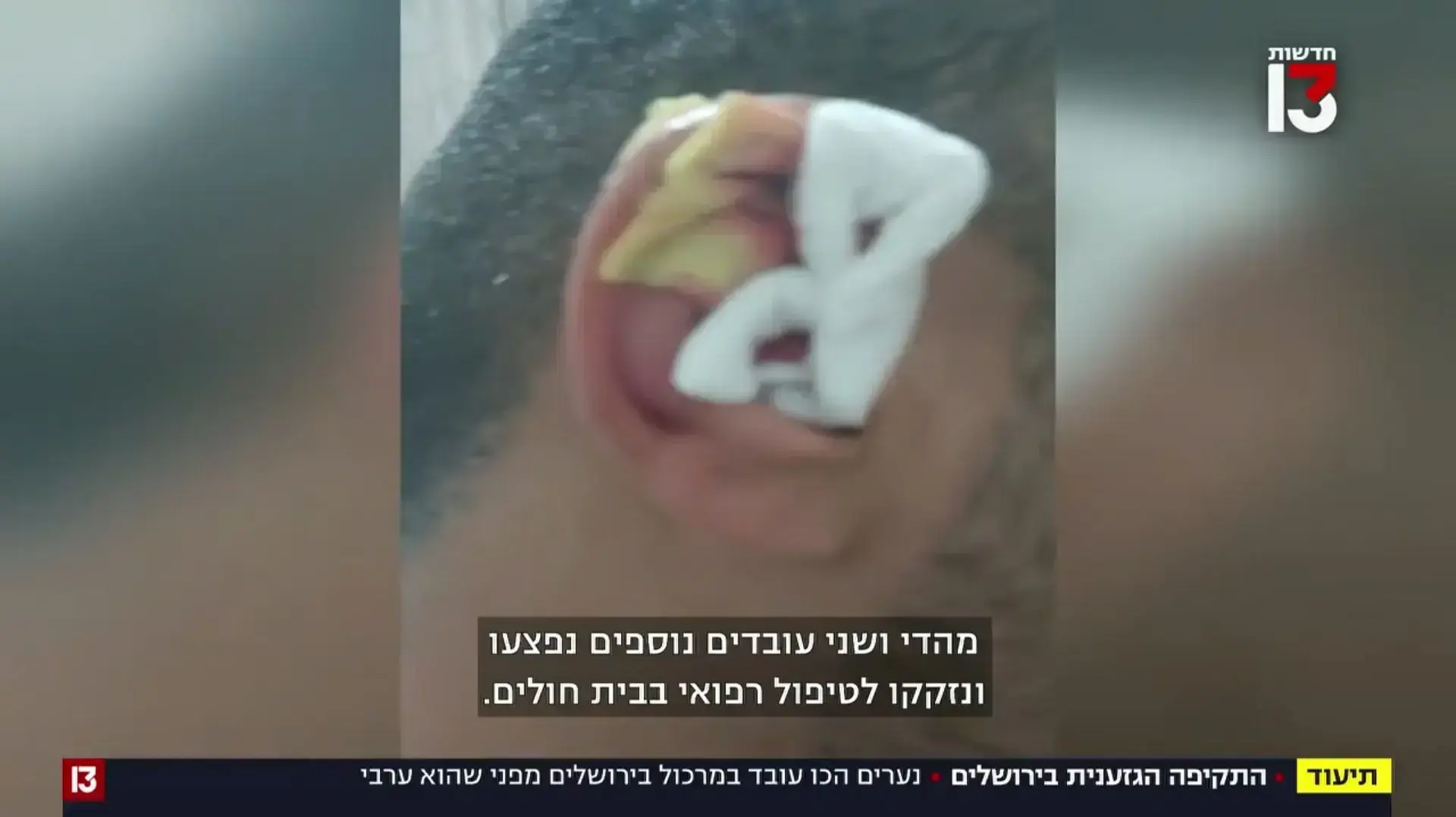 כתבה על התקיפה הגזענית בירושלים כתבה על התקיפה הגזענית בירושלים