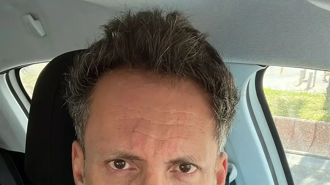 ד"ר אייל חשביה, מנהל בכיר במערך הטראומה והכירורגיה הדחופה, בית חולים איכילוב ד"ר אייל חשביה, מנהל בכיר במערך הטראומה והכירורגיה הדחופה, בית חולים איכילוב