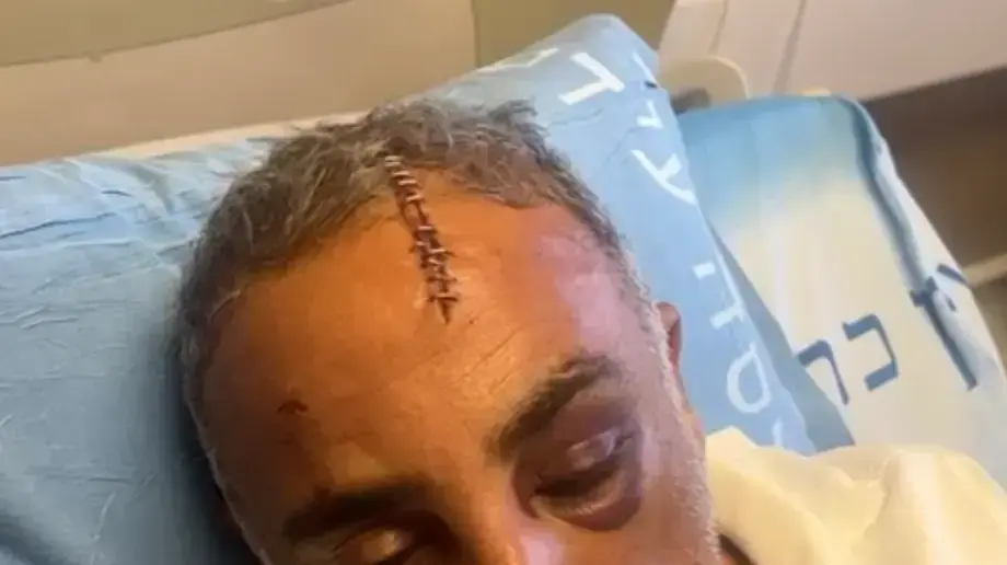 תושב שייח ג'ראח הותקף בידי רעולי פנים, 13 אוקטובר 2022 תושב שייח ג'ראח הותקף בידי רעולי פנים, 13 אוקטובר 2022
