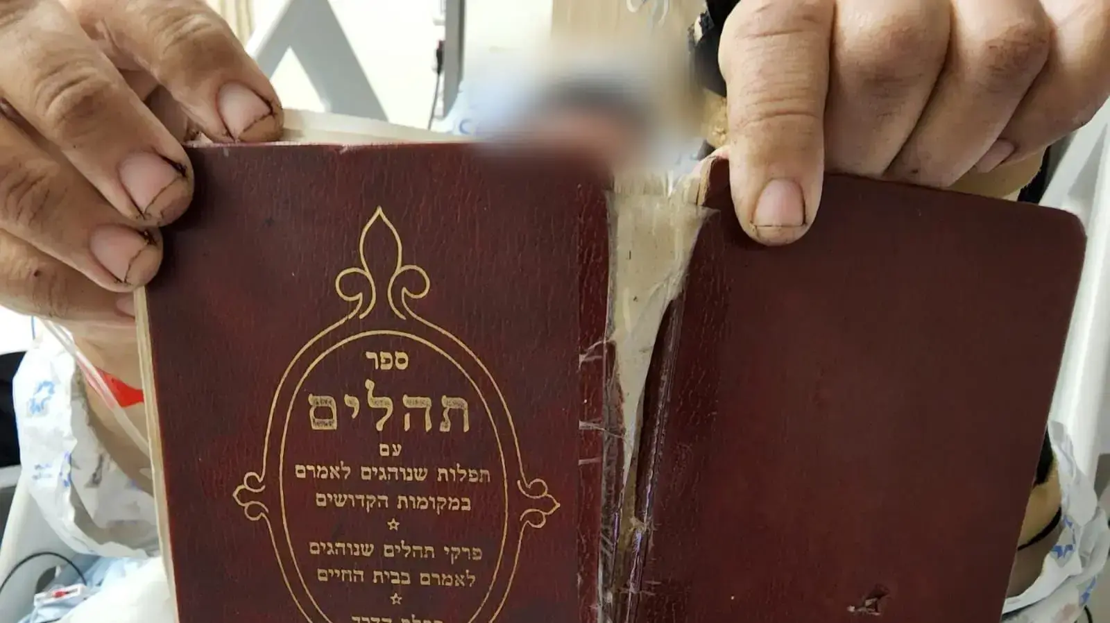 ספר התהילים שמנע את חדירת הרסיס לגופו של הפצוע בפיגוע בירושלים