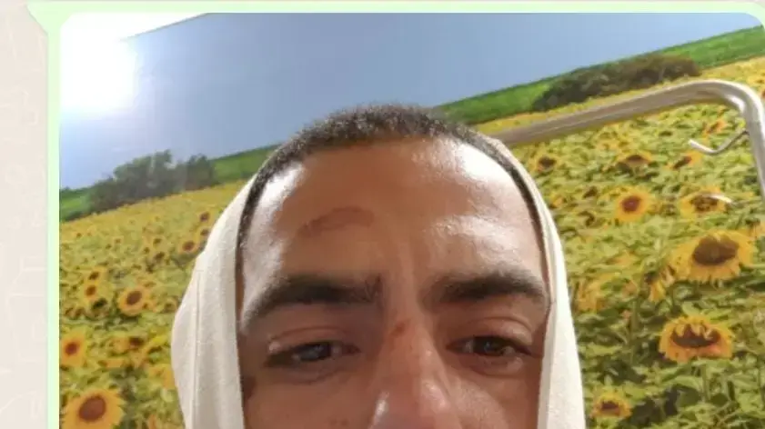 טל סיגוואי, נפצע בתאונת קורקינט חשמלי בתל אביב וטופל בבית החולים איכילוב טל סיגוואי, נפצע בתאונת קורקינט חשמלי בתל אביב וטופל בבית החולים איכילוב