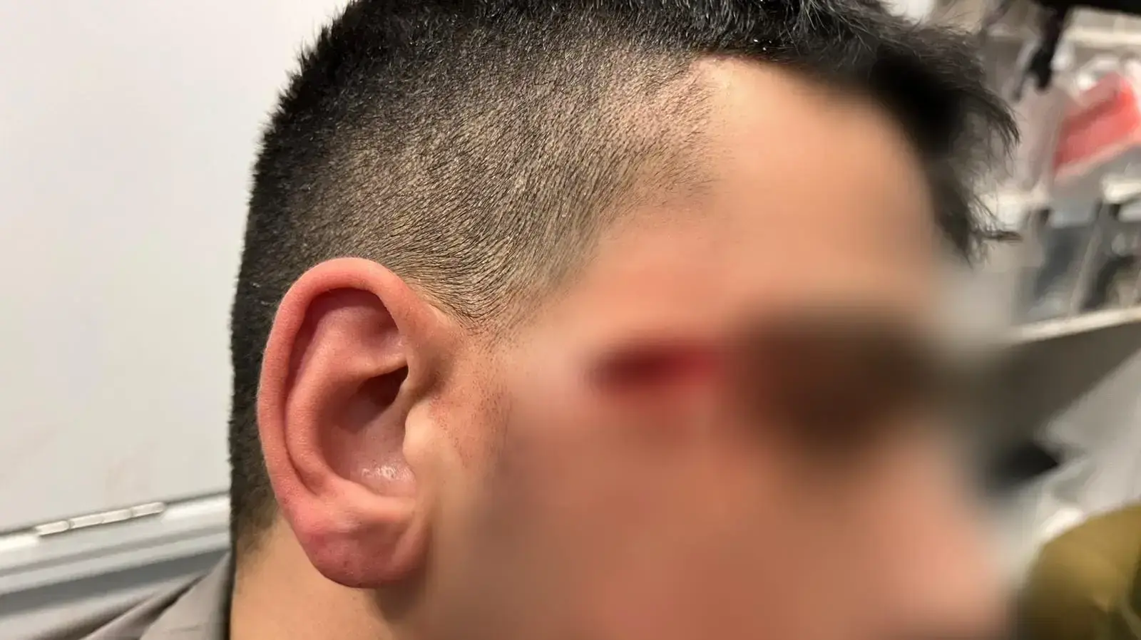לוחם מג"ב נפצע קל לאחר שמחבל פלסטיני ניסה לדקור אותו בחווארה שבשומרון, המחבל נוטרל ע"י לוחם נוסף. 2 בדצמבר 2022 לוחם מג"ב נפצע קל לאחר שמחבל פלסטיני ניסה לדקור אותו בחווארה שבשומרון, המחבל נוטרל ע"י לוחם נוסף. 2 בדצמבר 2022