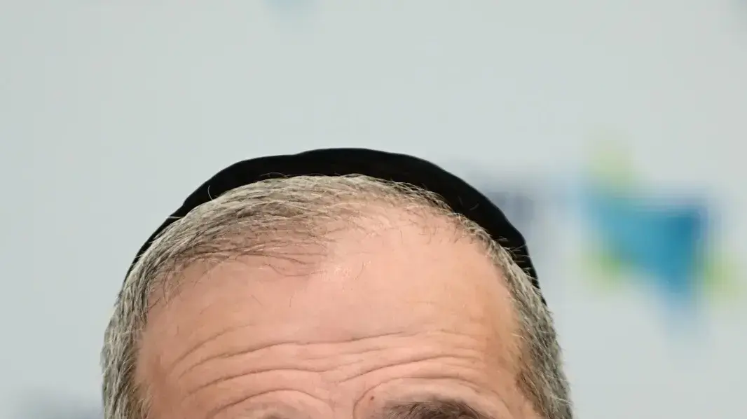 אריה דרעי, שר הבריאות בהגשת המלצות הוועדה הציבורית להרחבת סל שרותי הבריאות לשנת 2023, בית שרמן מתחם בי"ח תל השומר, 18 בינואר 2023 אריה דרעי, שר הבריאות בהגשת המלצות הוועדה הציבורית להרחבת סל שרותי הבריאות לשנת 2023, בית שרמן מתחם בי"ח תל השומר, 18 בינואר 2023