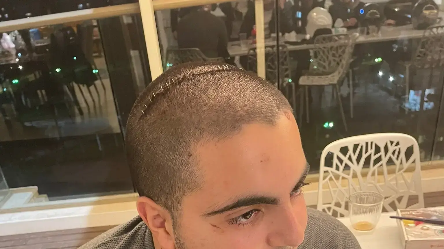 החייל שהותקף לאחר שהפריד בקטטה ברמת אביב. ינואר 2023 החייל שהותקף לאחר שהפריד בקטטה ברמת אביב. ינואר 2023